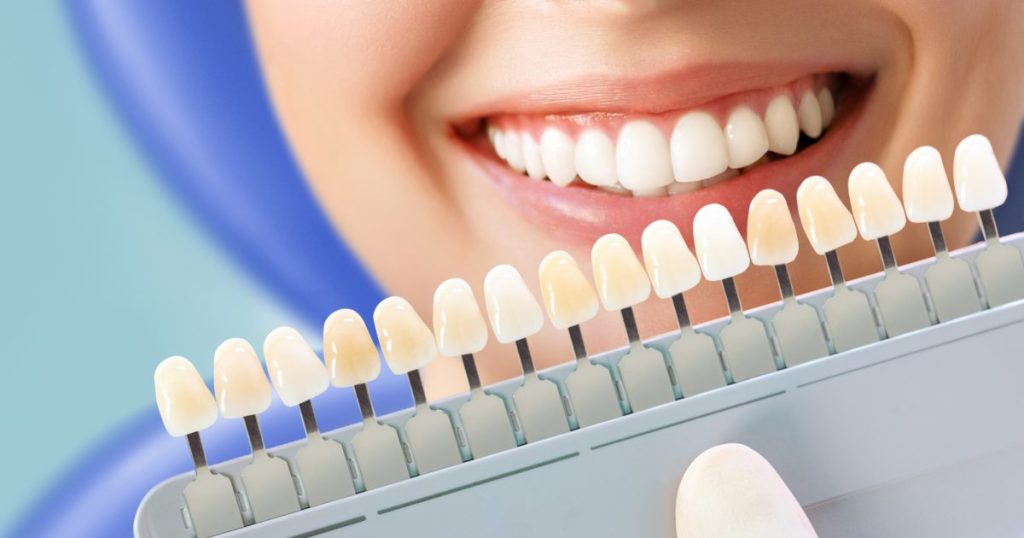 teeth whitening treatments